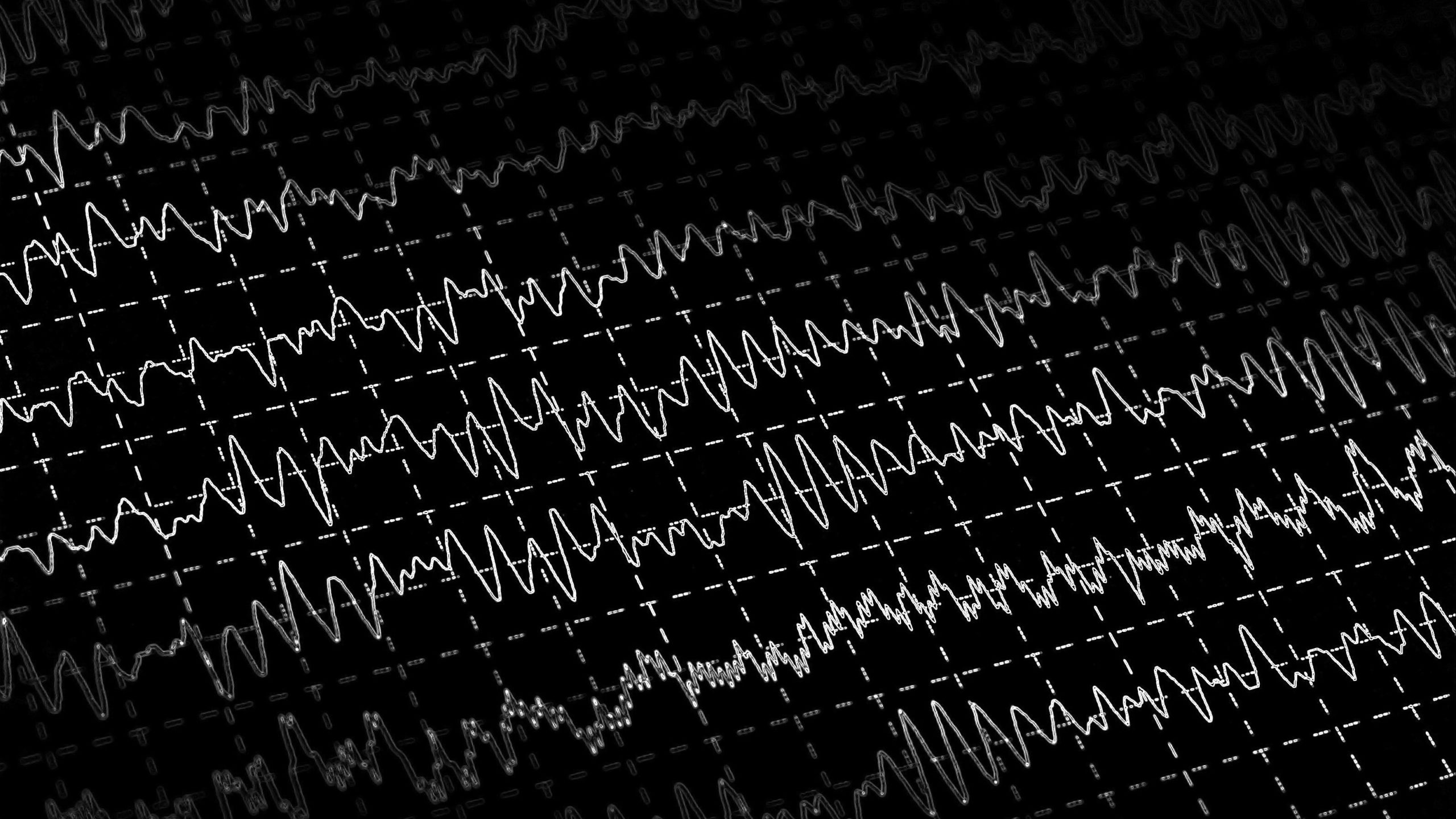 tech-is-rewiring-your-brain-brain-eeg-activity-graph