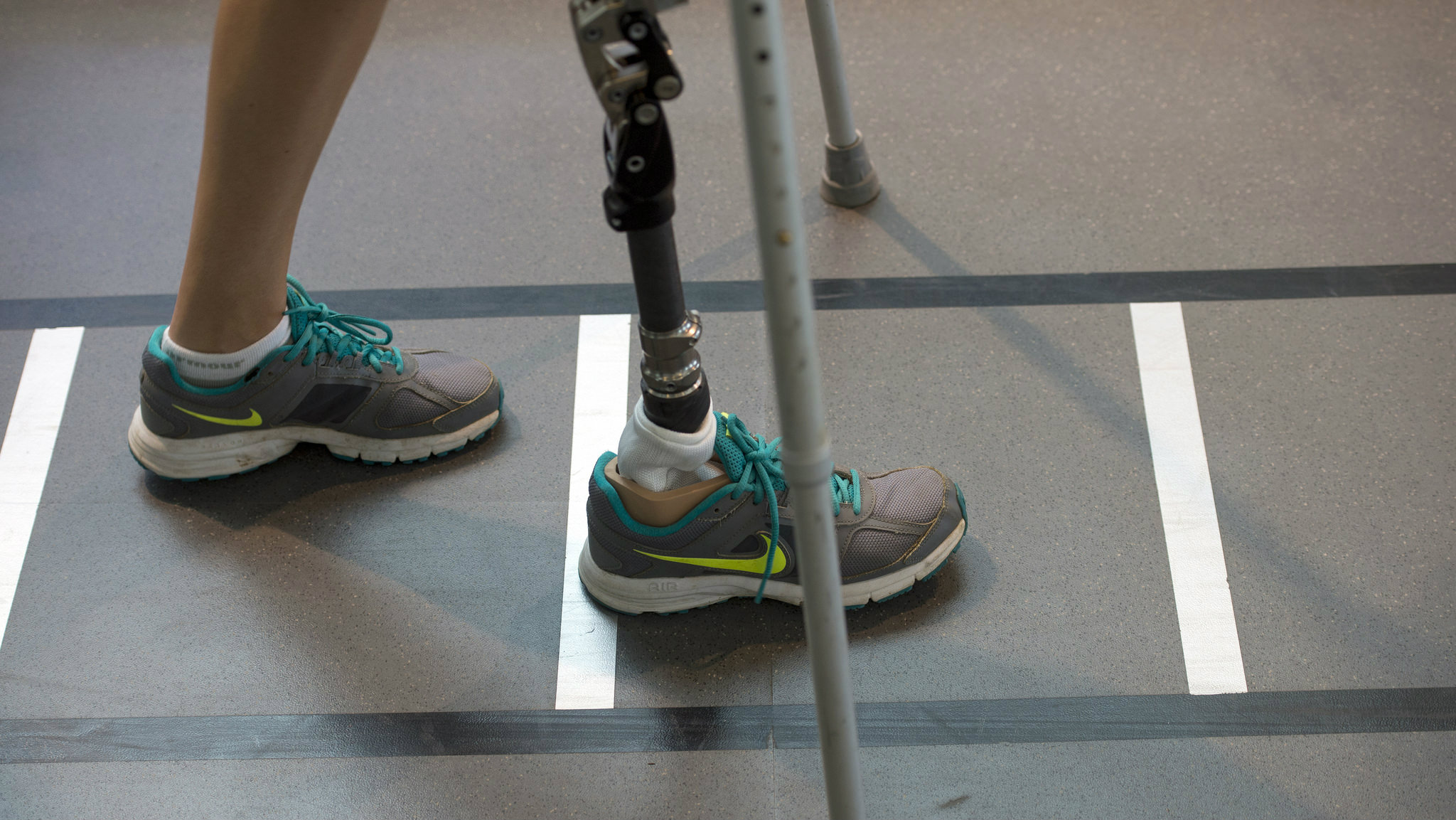 artificial_limb