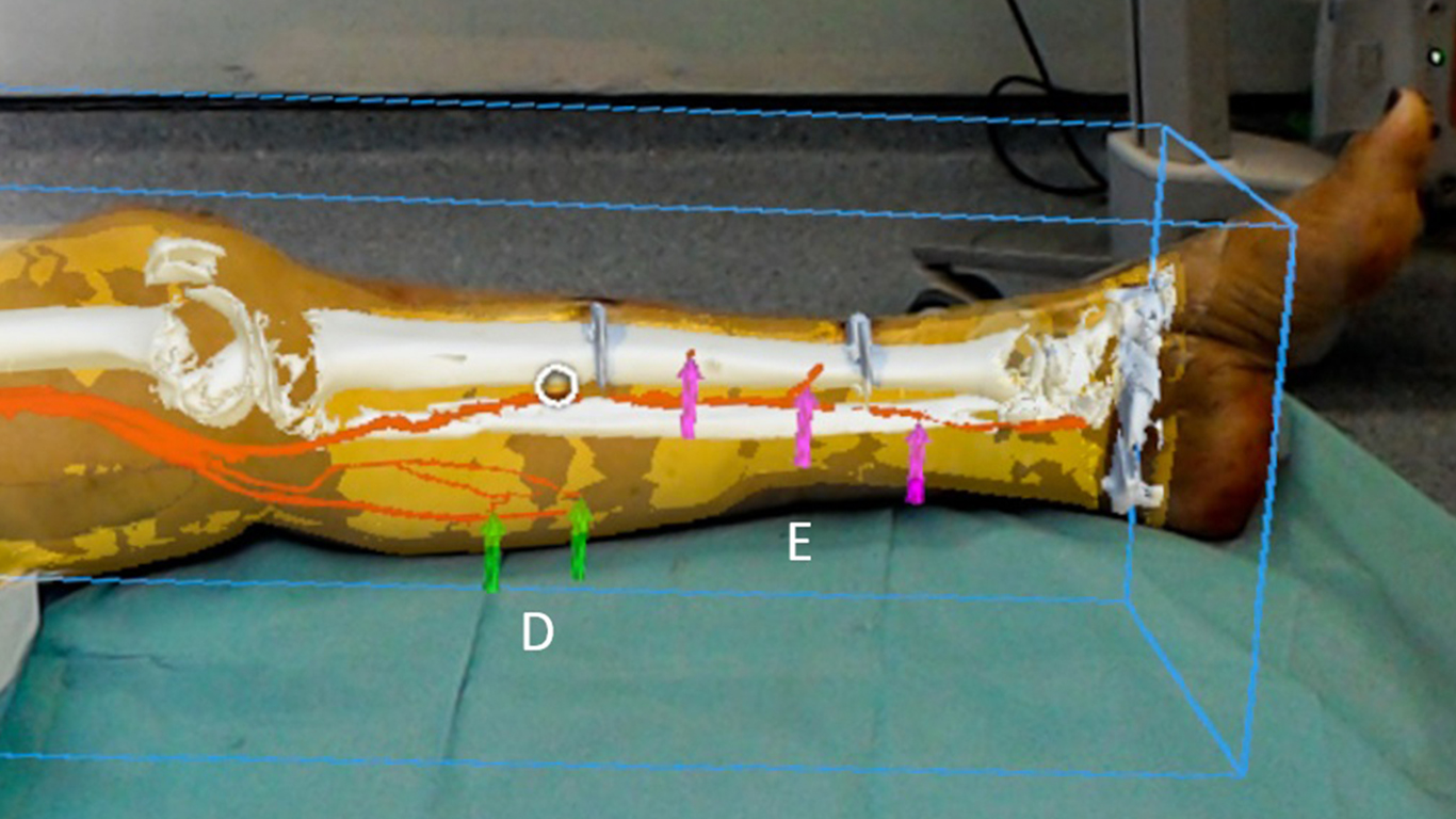 microsoft_hololens_2