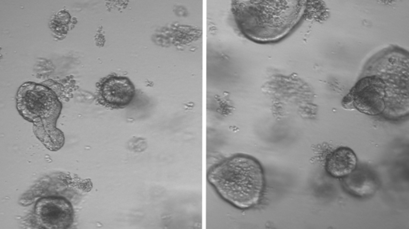 mit-stem-cell-diet_0